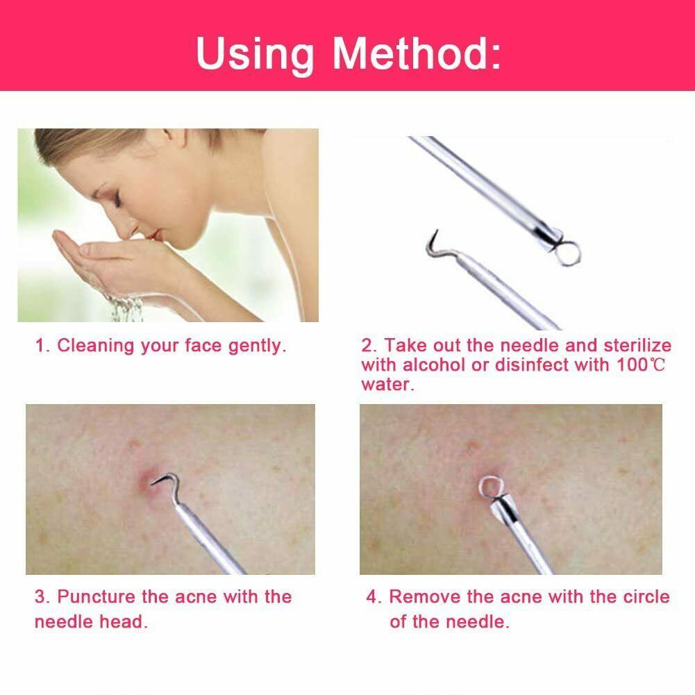 Ear Wax Remover Spoon Earwax Picker And Pimple Blackhead Remover Tools - COMBO KIT