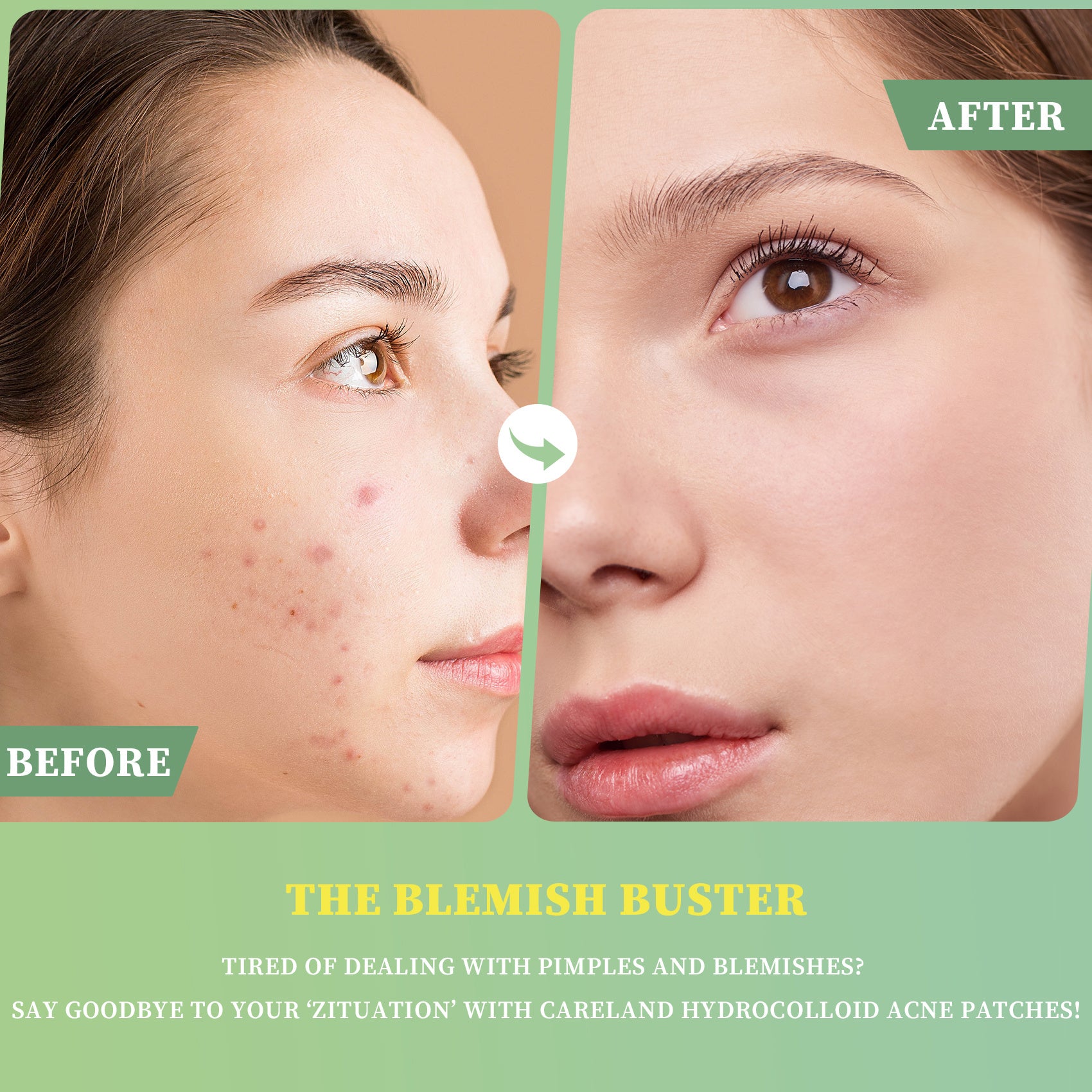 Essential oil acne patch